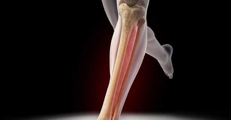 Как долго нужно ходить с гипсом при переломе берцовой кости