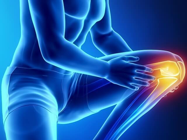 Что такое контрактура коленного сустава и как ее предотвратить