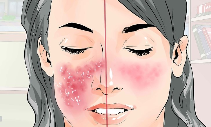 Прыщи на половых губах почему появляются и возможные заболевания