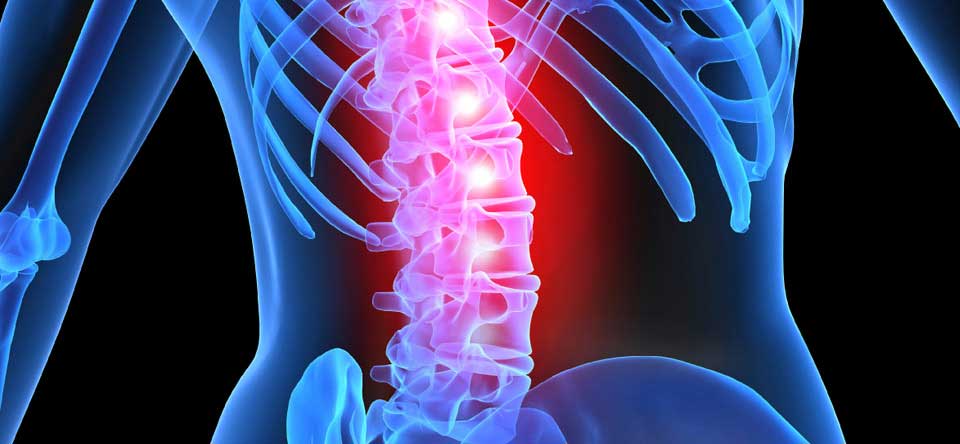 Все о травмах спинного мозга — какие бывают и как их лечить