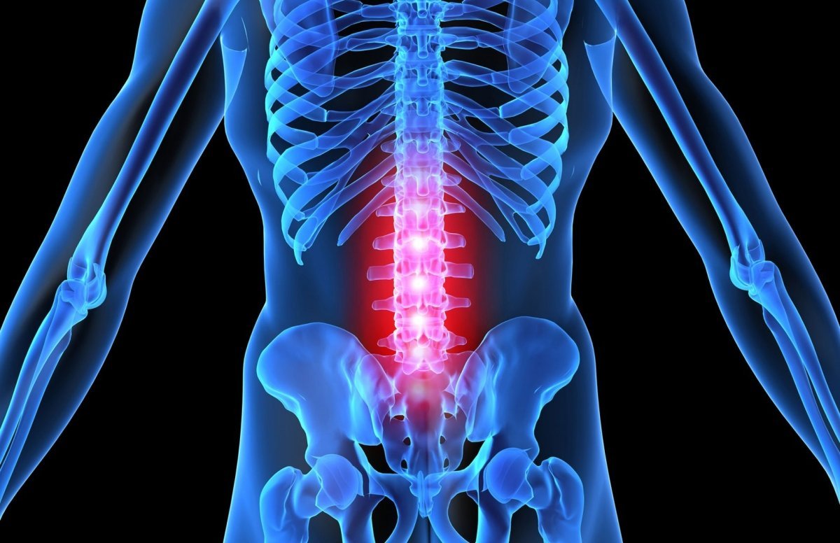 Все о травмах спинного мозга — какие бывают и как их лечить