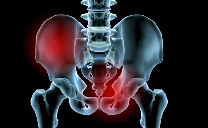 Диагностика и лечение при переломе костей таза
