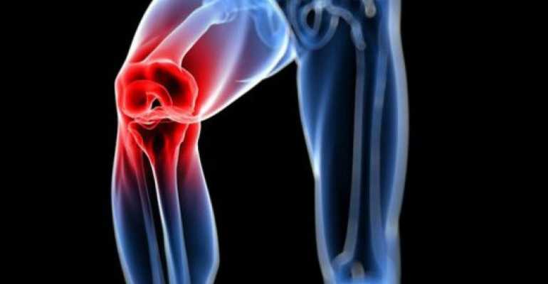 Диагностика и профилактика двустороннего гонартроза коленного сустава