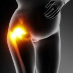 Эффективные способы устранения боли в коленях после родов