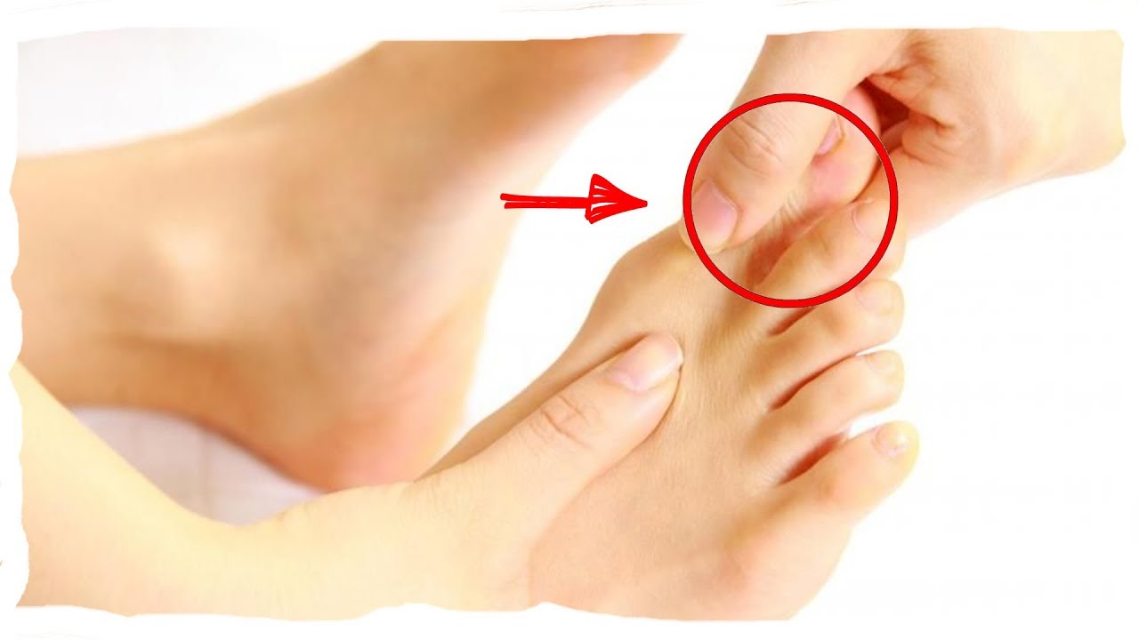 Почему хрустят пальцы на ногах
