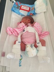 Ортопедическое приспособление для новорожденных — подушка Фрейка