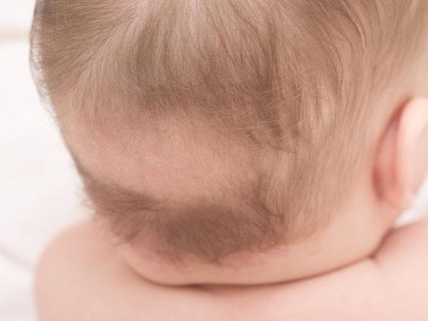 Выпадение волос у грудничка естественный процесс или патология