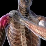 Упражнения для лечения и профилактики артроза плечевого сустава